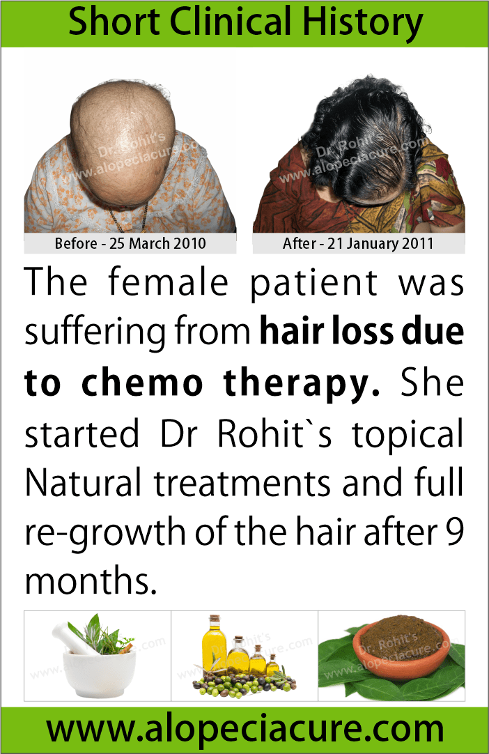 Chemotherapy hair loss