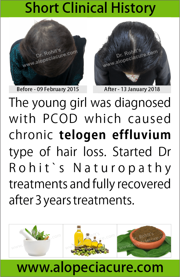 chronic telogen effluvium treatment