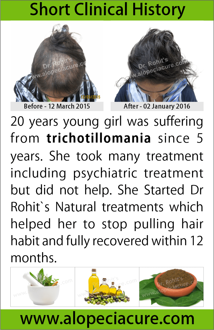 trichotillomania treatment