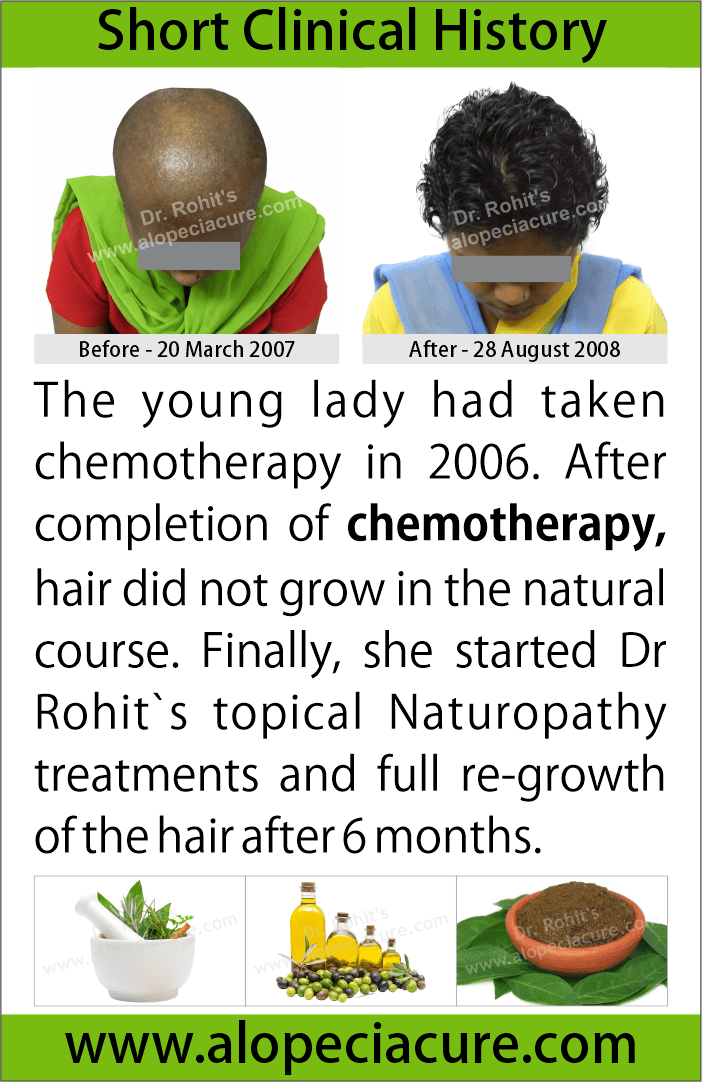 Chemotherapy hair loss