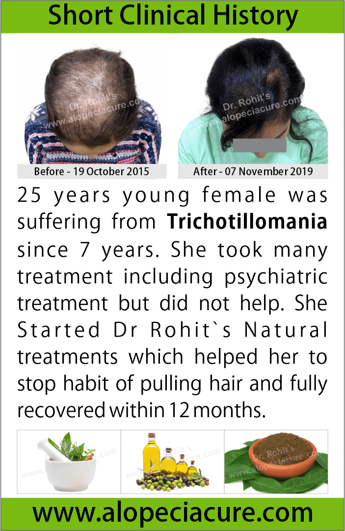 trichotillomania treatment